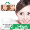 Anti Stains Acne Treatment Cream Scar Blackhead Face Cream Shrink Pores Whitening Skin Care Face Cream Korean Cosmetics - 50G