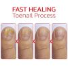 NailHelper Ingrowth Toenail Correction Treatment Oil - 1