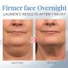 Sleeping V-Face Beauty Device - 1