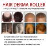 Hair Micro 540 Roller Derma Roller Dermaroller Titanium Promot Hair Regrowth Beard Growth Anti Hair Loss Treat Thinning Receding - China - 01
