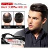 Hair Micro 540 Roller Derma Roller Dermaroller Titanium Promot Hair Regrowth Beard Growth Anti Hair Loss Treat Thinning Receding - China - 01